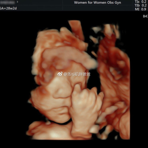 a8a11ba9gy1fl3jo15ow8j20y00y0ncj 500x500 - 去做美国试管婴儿如何提升卵子质量