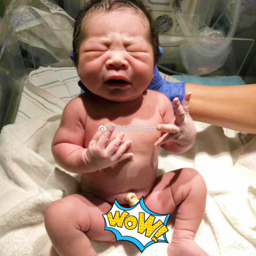 a8a11ba9gy1fmhismebpsj20u00u0tvh 500x500 - 恭喜赴美生子广东客人顺利生产带着宝宝割包皮