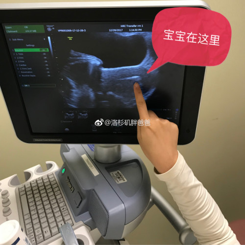 a8a11ba9gy1fn08phprg2j22c02c17wl 500x500 -  美国试管婴儿冷冻胚胎成功率更高