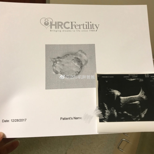 a8a11ba9gy1fn08q5id52j22c02c0x6s 500x500 - 成都客人备孕失败到美国做试管顺利移植囊胚