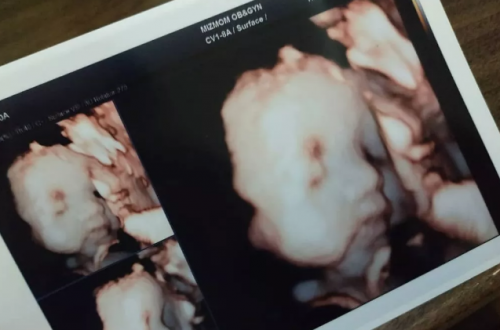 11 500x330 - 重庆客人的爱心妈妈成功分娩8磅2盎司宝宝