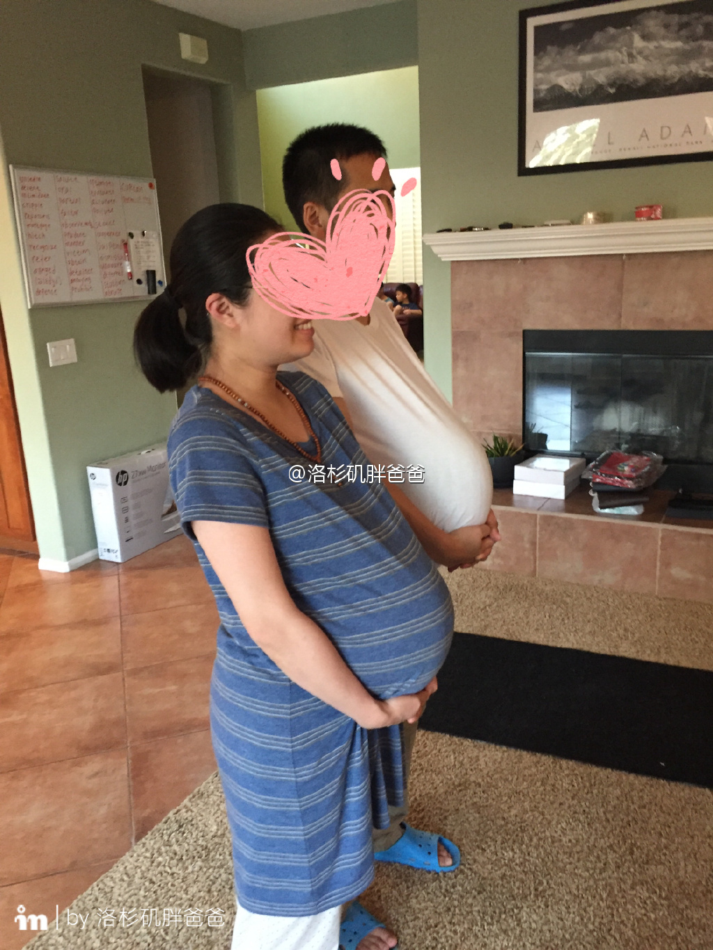 西瓜 - 浙江客人赴美生子入住喜多月子中心 丈夫抱瓜模仿客人怀孕状态