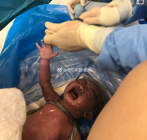 微信截图 20180111174518 - 胎儿脐带绕颈孕妈妈可以赴美生子吗