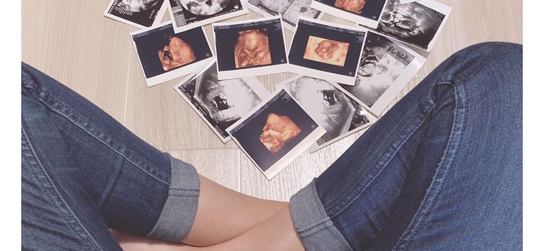 96750331 755811468286749 6818426596188393381 n 1080x500 - 美国试管婴儿周期被暂停或取消怎么办