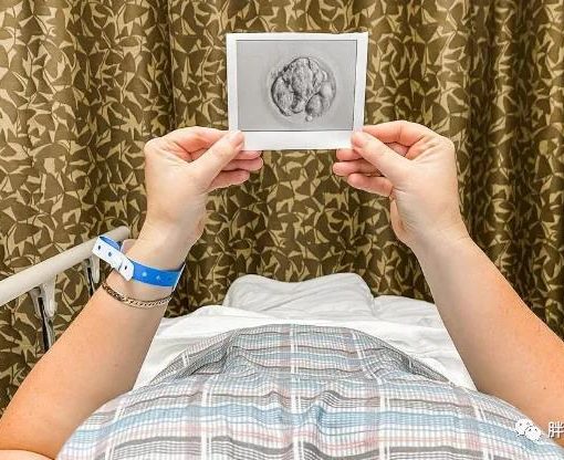 美国试管婴儿流程——山东夫妇赴美试管选性别 微信图片 20210907154535 510x416 - 美国试管婴儿流程——山东夫妇赴美试管选性别