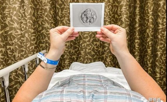 微信图片 20210907154535 570x350 - 美国试管婴儿流程——山东夫妇赴美试管选性别